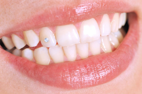 Swarovski Tooth Gems